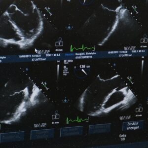 Echographe pour professionnel